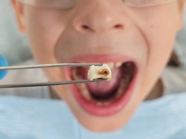 Best Emergency Gum Treatment in Blanchester, OH